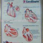 Plastic/pvc 3D Medical Chart